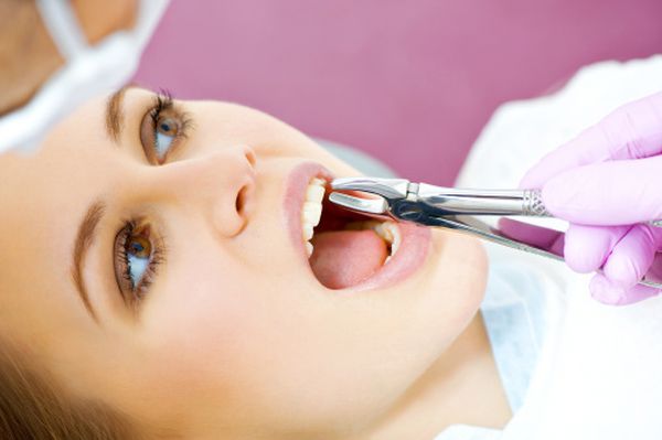 خون ناشی از کشيدن دندان روزه را باطل می کند؟