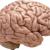 آیا سایز مغز در هوش تأثیر دارد؟