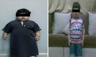  چاق ترین کودک دنیا لاغر شد+عکس