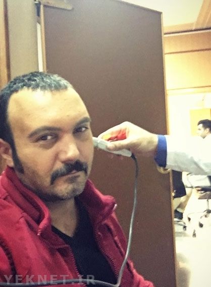 (عکس) پرده گوش کامبیز دیرباز پاره شد