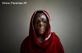 اسیدپاشی مرد شیشهای روی 4 کارگر