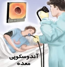 درمان غیرجراحی چاقی با آندوسکوپی