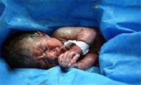 دختر هنگکنگی با دو بچه در شکم (عکس)