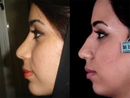 حکم شرعی سوراخ‌ کردن بینی