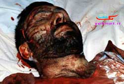 پيكر مطهر شهيد صياد شيرازي هنگام شهادت + عكس