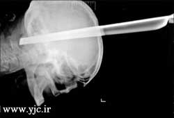 نجات معجزه‌آسا مردی از یک نزاع +عکس