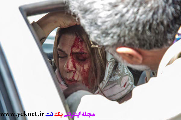 گوهر خیراندیش پس از تصادف + عكس