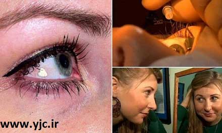 کاشت جواهر بر روی چشم ! +عکس