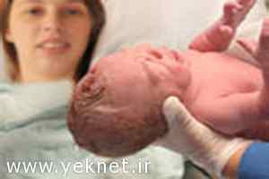 چطور پس از سزارین سریعتر خوب شویم؟