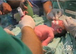 تولد يك نوزاد بعد از شهادت مادرش در غزه /عكس