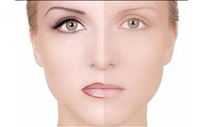 همه چیز در مورد میکروپیگمنتیشن و کاربردهای آن