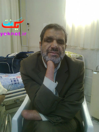 درد دل سوزناك دختر يك جانباز
