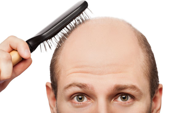 علت ریزش مو در جوانی