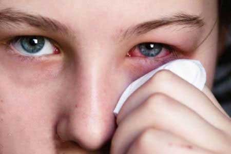 به مواد آرایشی حساسیت دارید؟