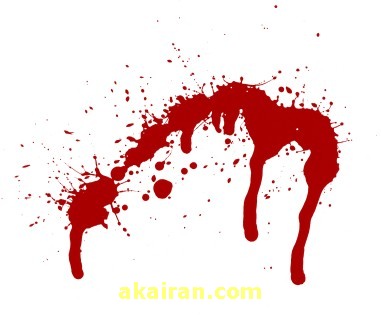 چرا خون انسان بعد از بیرون آمدن از بدن نجس میشود؟