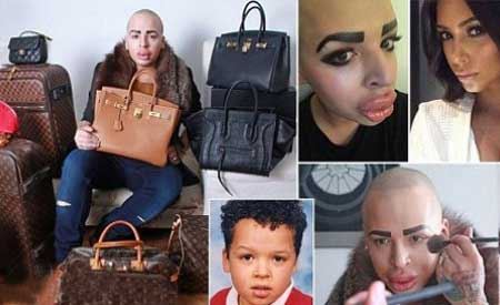 |عکس| جراحی پسر جوان برای شبیه شدن به کیم کارداشیان