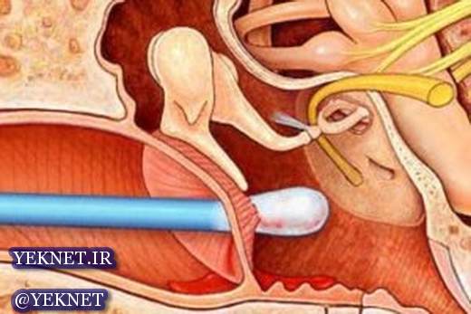 پرده گوش کی پاره میشود؟