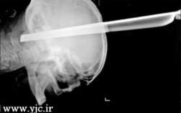 نجات معجزه‌آسا مردی از یک نزاع +عکس