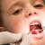 درمان پوسیدگی دندان شیری چیست؟