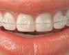 ارتودنسی و کاربرهای ارتودنسی